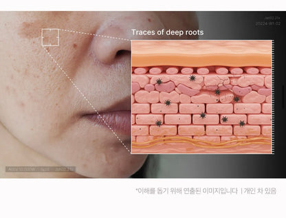 PDRN Pink Niacinamide Milky Toner - Medicube