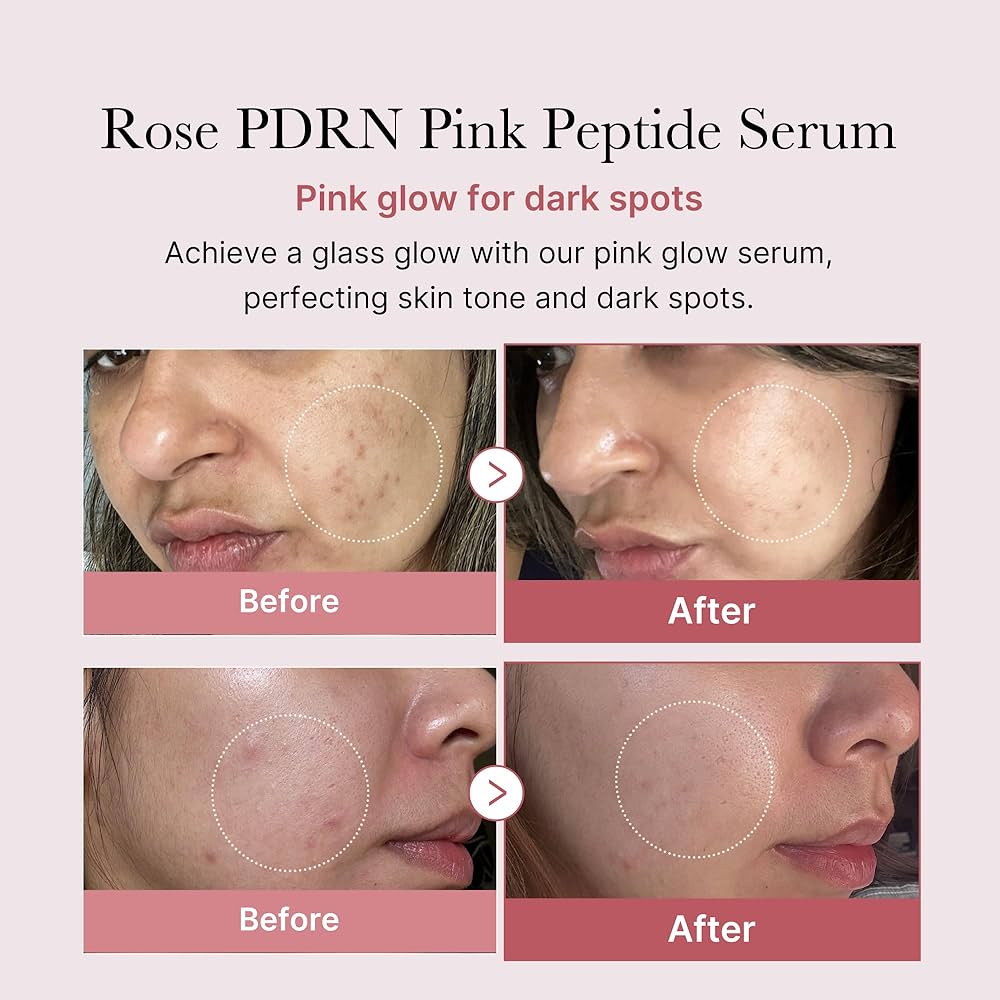 PDRN Pink peptide serum | ADN de Salmón | medicube Perú