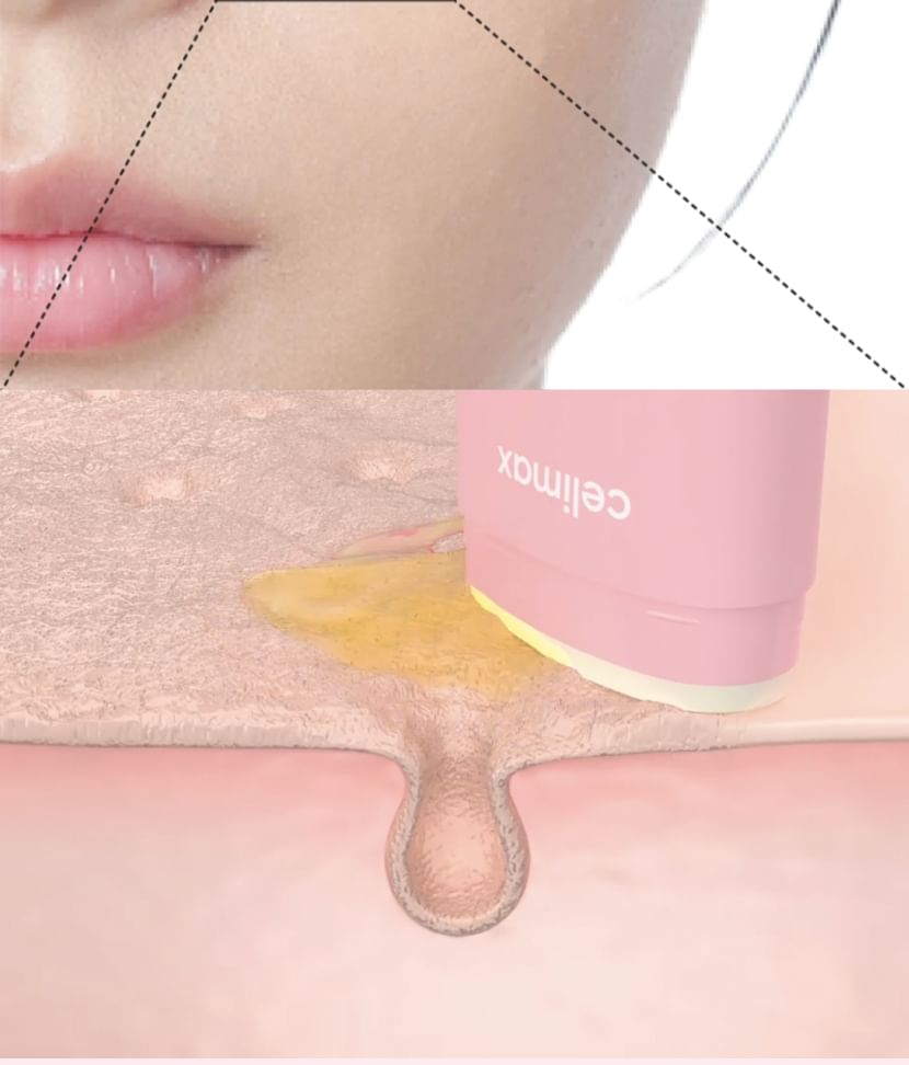 Celimax - Oil Control Mattifying Sun Stick SPF 50+ PA++++
